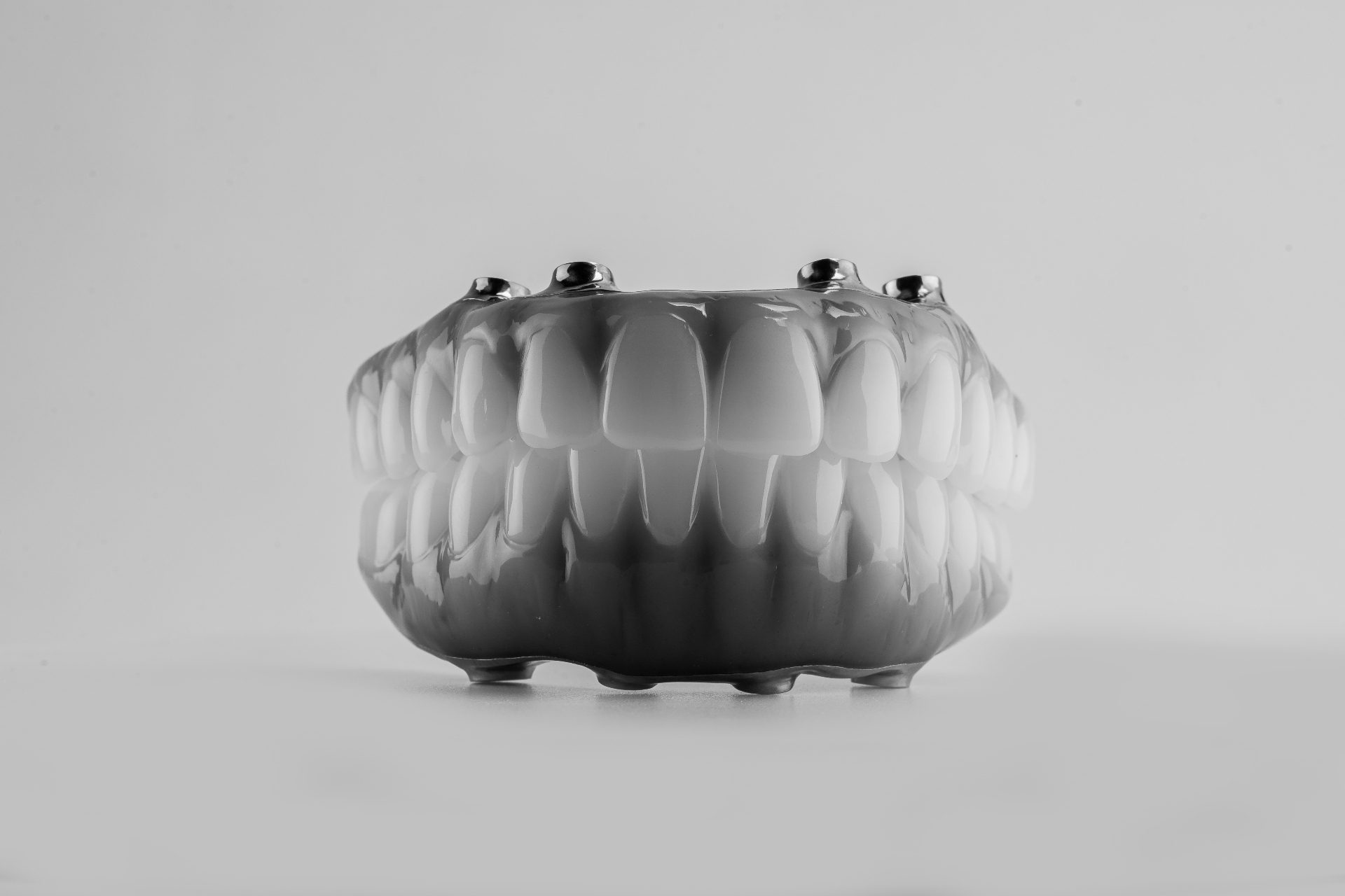 Full-arch All-on-4 dental prosthesis showing four implant attachment points